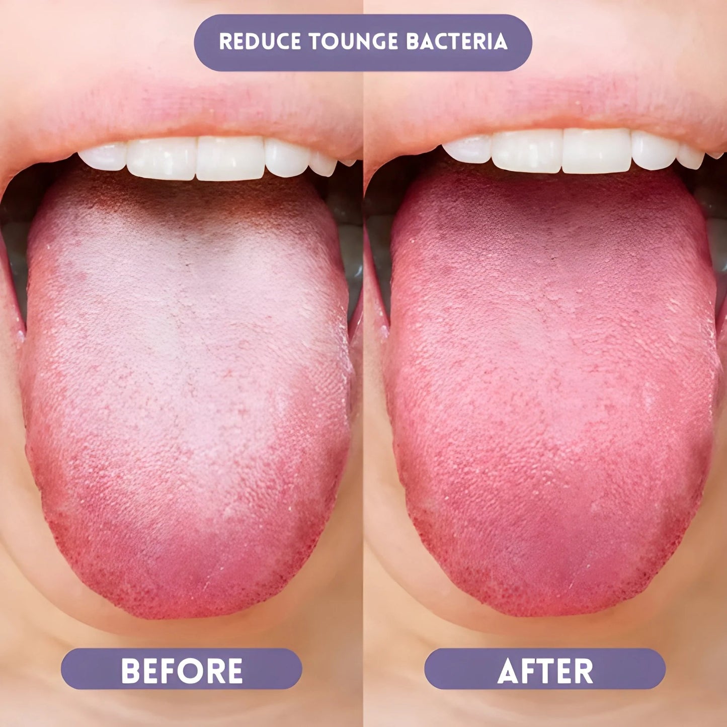 🎁Last Day 50%OFF🦷 Probiotic Oral Spray🍋