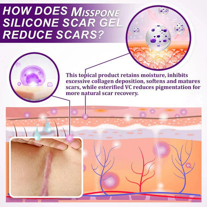 Mispone™ Face & Body Scar Gel – Clinically Proven Formula to Soften, Flatten & Fade Scars from Surgery, Acne, Burns, and Keloids