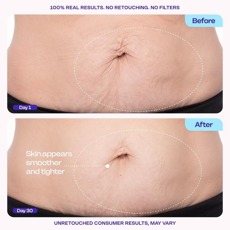 💕Hot sale 49% OFF💖🌸 New! Tighten & Smooth Belly Firming Cream