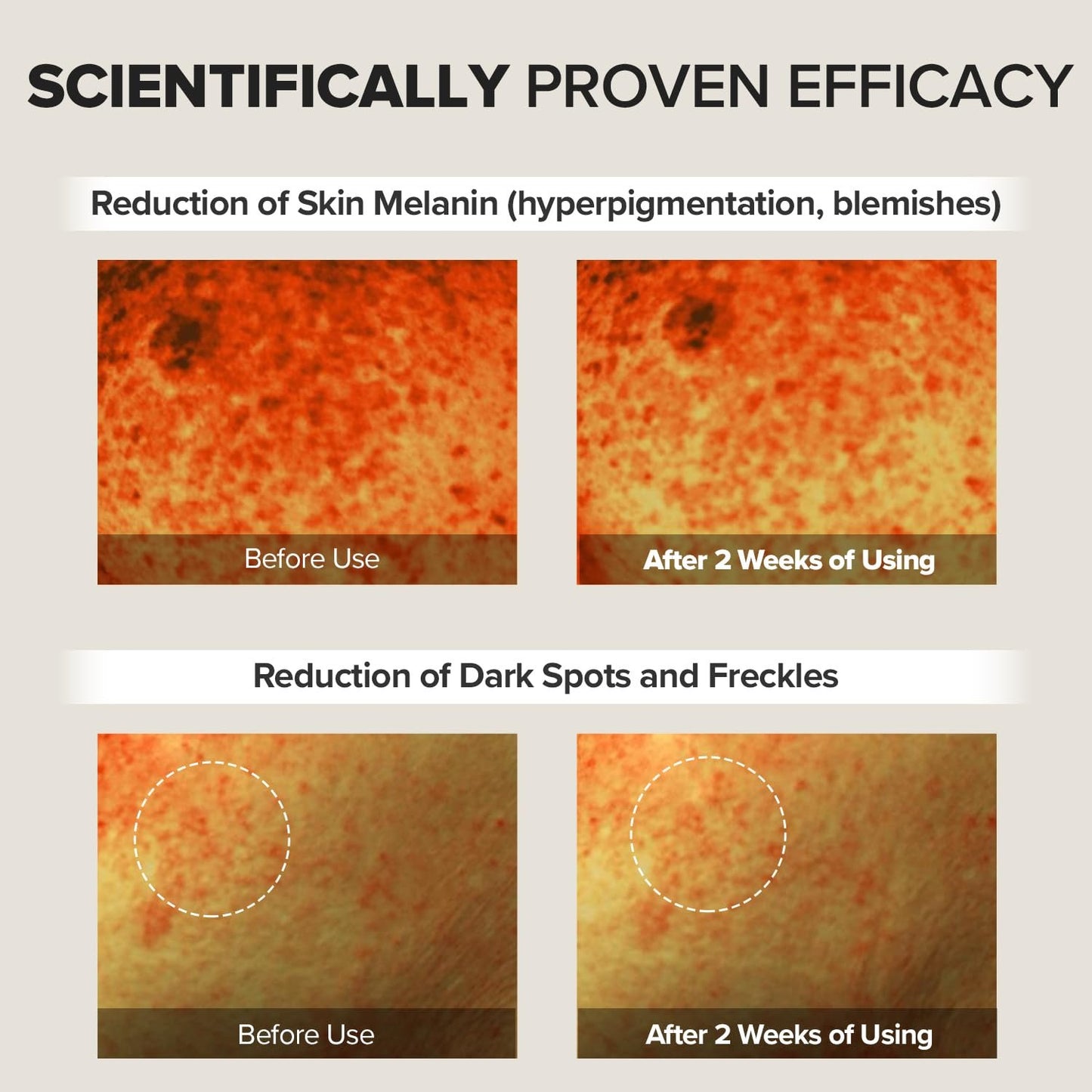 Eye Bag Instant Eraser, Tightens, Firms, & Blurs Wrinkles