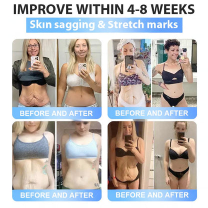 FDA Store | 𝐍𝐚𝐭𝐫𝐚𝐯𝐨𝐫™ 𝐒𝐥𝐢𝐦 & Firm 𝑁ano 𝑀icroneedle 𝑃atch with Collagen, Turmeric & Matrixyl 3000丨Obesity, Cardiovascular Disease, Diabetes, Sleep Apnea, Joint Problems and More