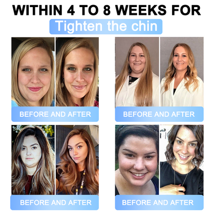 FDA Store | 𝐍𝐚𝐭𝐫𝐚𝐯𝐨𝐫™ 𝐒𝐥𝐢𝐦 & Firm 𝑁ano 𝑀icroneedle 𝑃atch with Collagen, Turmeric & Matrixyl 3000丨Obesity, Cardiovascular Disease, Diabetes, Sleep Apnea, Joint Problems and More