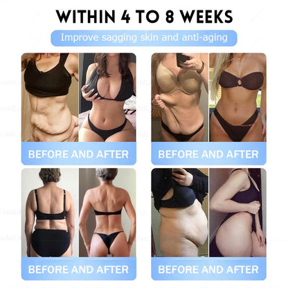 FDA Store | 𝐍𝐚𝐭𝐫𝐚𝐯𝐨𝐫™ 𝐒𝐥𝐢𝐦 & Firm 𝑁ano 𝑀icroneedle 𝑃atch with Collagen, Turmeric & Matrixyl 3000丨Obesity, Cardiovascular Disease, Diabetes, Sleep Apnea, Joint Problems and More