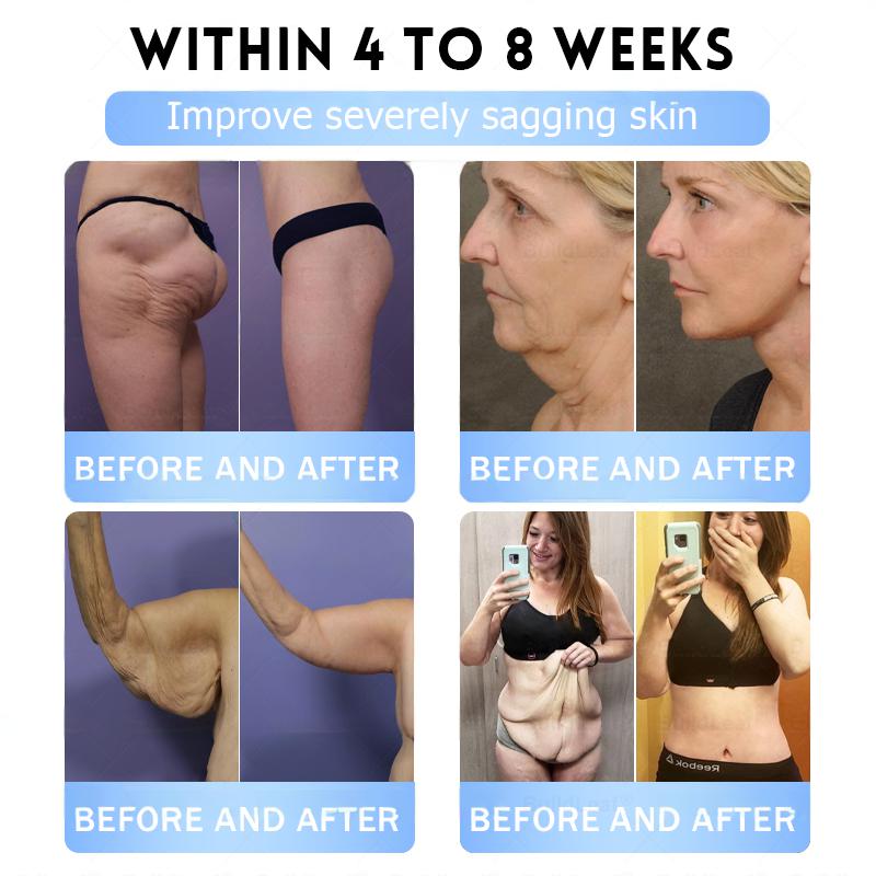 FDA Store | 𝐍𝐚𝐭𝐫𝐚𝐯𝐨𝐫™ 𝐒𝐥𝐢𝐦 & Firm 𝑁ano 𝑀icroneedle 𝑃atch with Collagen, Turmeric & Matrixyl 3000丨Obesity, Cardiovascular Disease, Diabetes, Sleep Apnea, Joint Problems and More