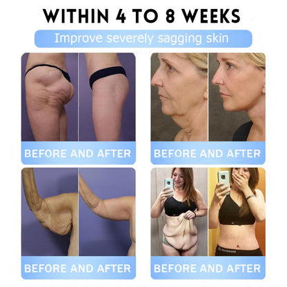 FDA Store | 𝐍𝐚𝐭𝐫𝐚𝐯𝐨𝐫™ 𝐒𝐥𝐢𝐦 & Firm 𝑁ano 𝑀icroneedle 𝑃atch with Collagen, Turmeric & Matrixyl 3000丨Obesity, Cardiovascular Disease, Diabetes, Sleep Apnea, Joint Problems and More