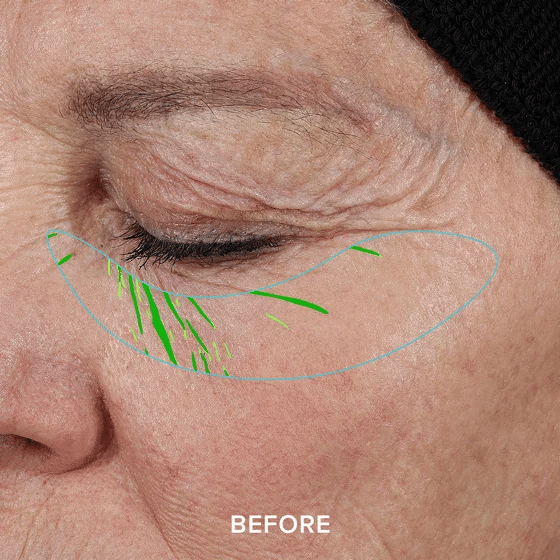 💥DRMTLGY Needle-less Growth Factor Serum💦