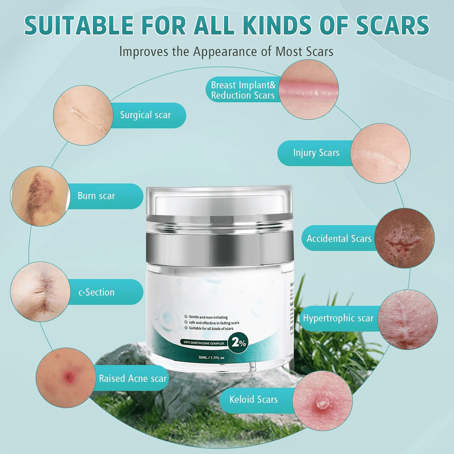 🔥Best scar gel out there -2% Silicone Scar Repair Cream