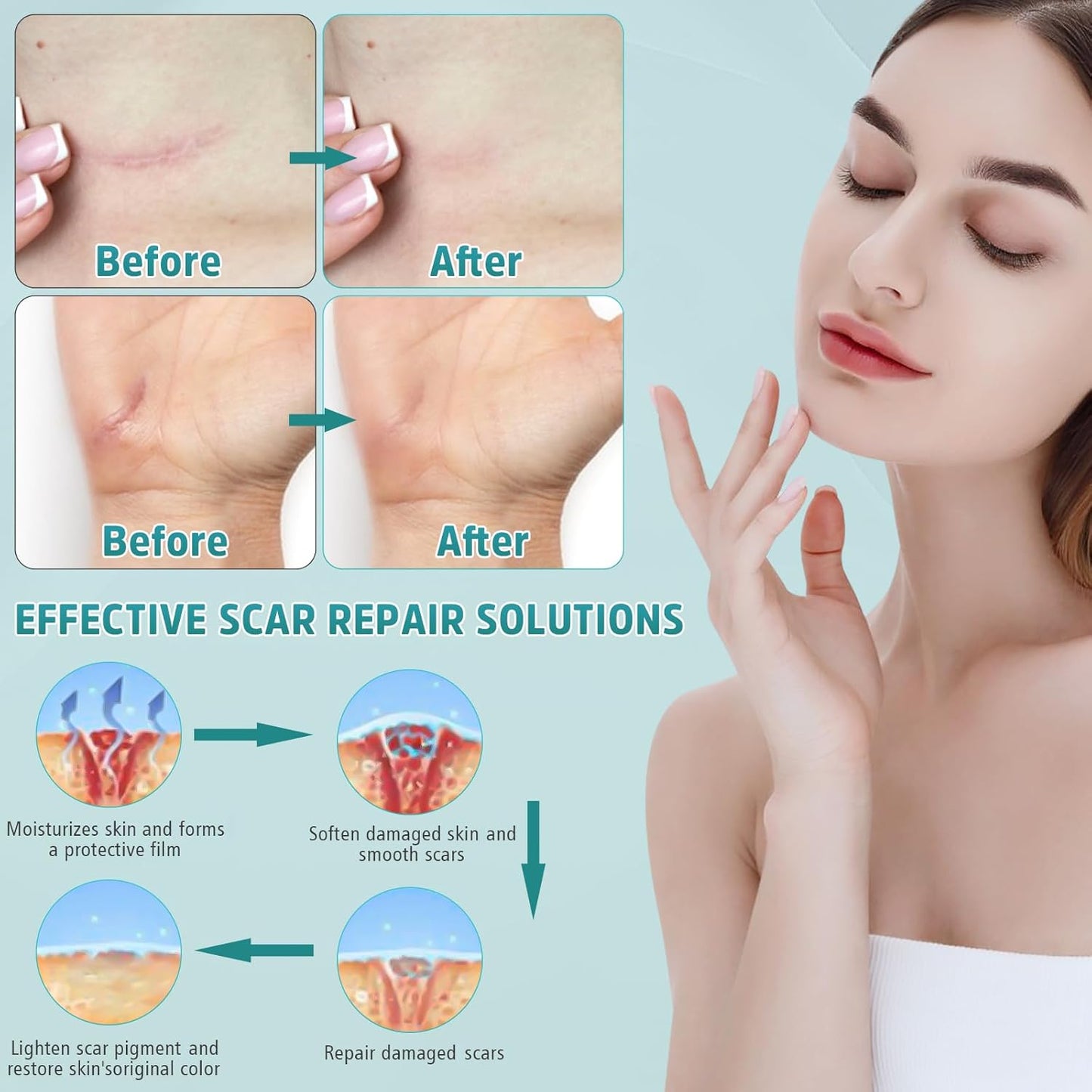 🔥Best scar gel out there -2% Silicone Scar Repair Cream