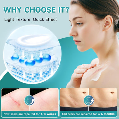 🔥Best scar gel out there -2% Silicone Scar Repair Cream