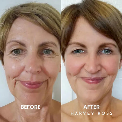 🏆#1 Bestselling🏆Harvey Ross - Instant Lift+