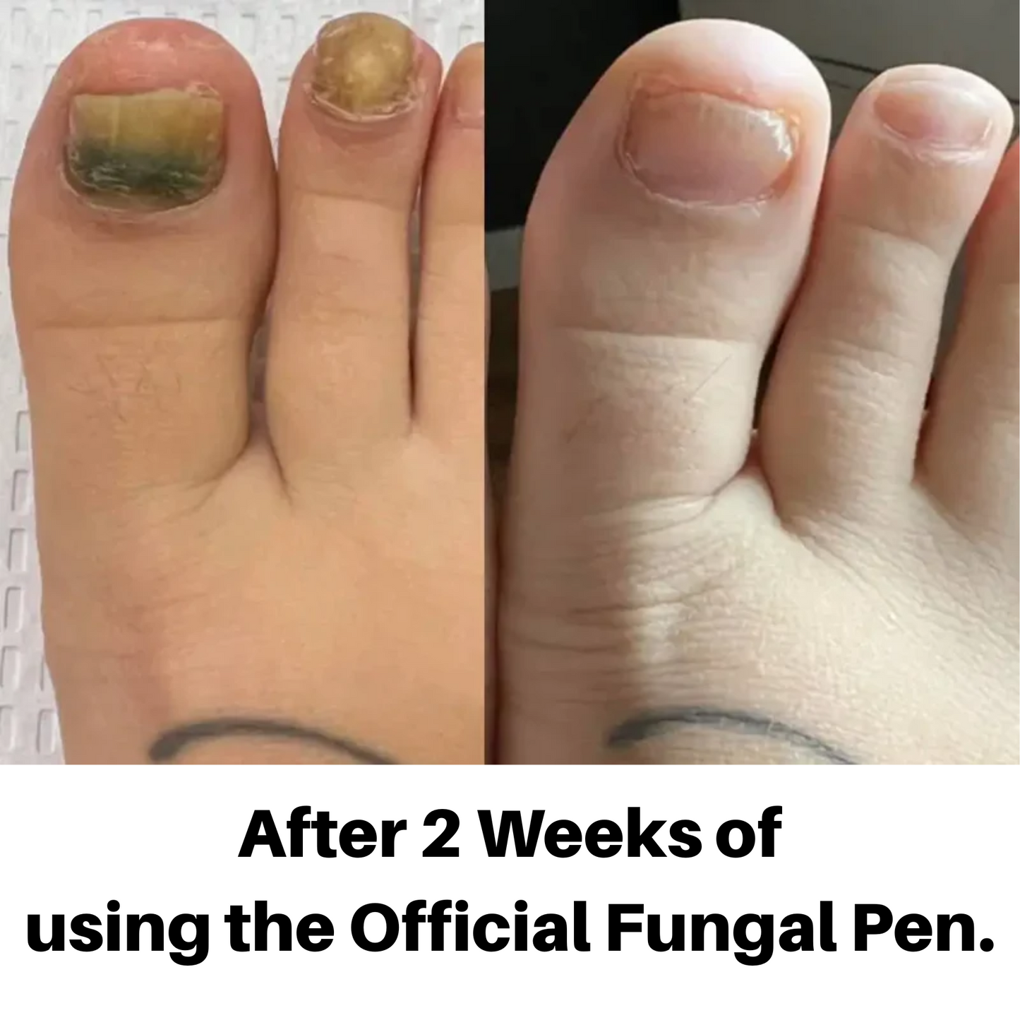 The Fungal Pen