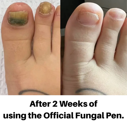 The Fungal Pen