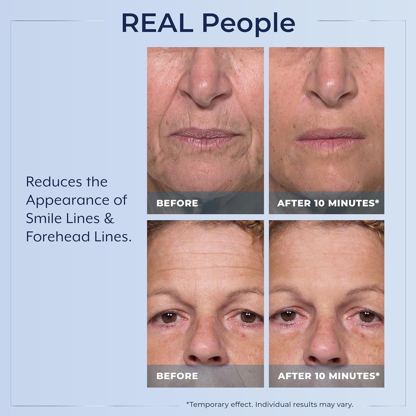 Plexaderm Rapid Reduction Eye Serum