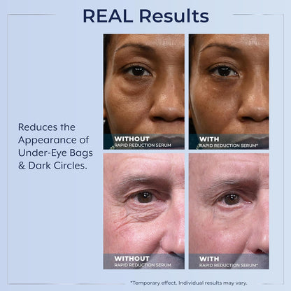 Plexaderm Rapid Reduction Eye Serum