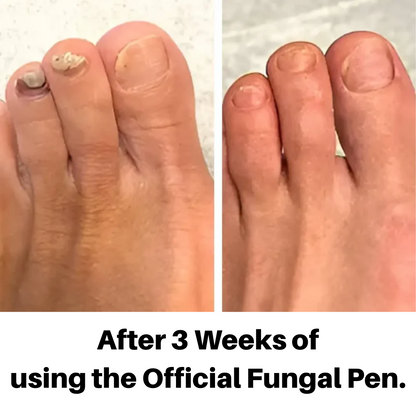 The Fungal Pen