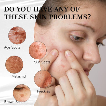 ⚡ Limited Stock💥Dark Spot Remover Serum