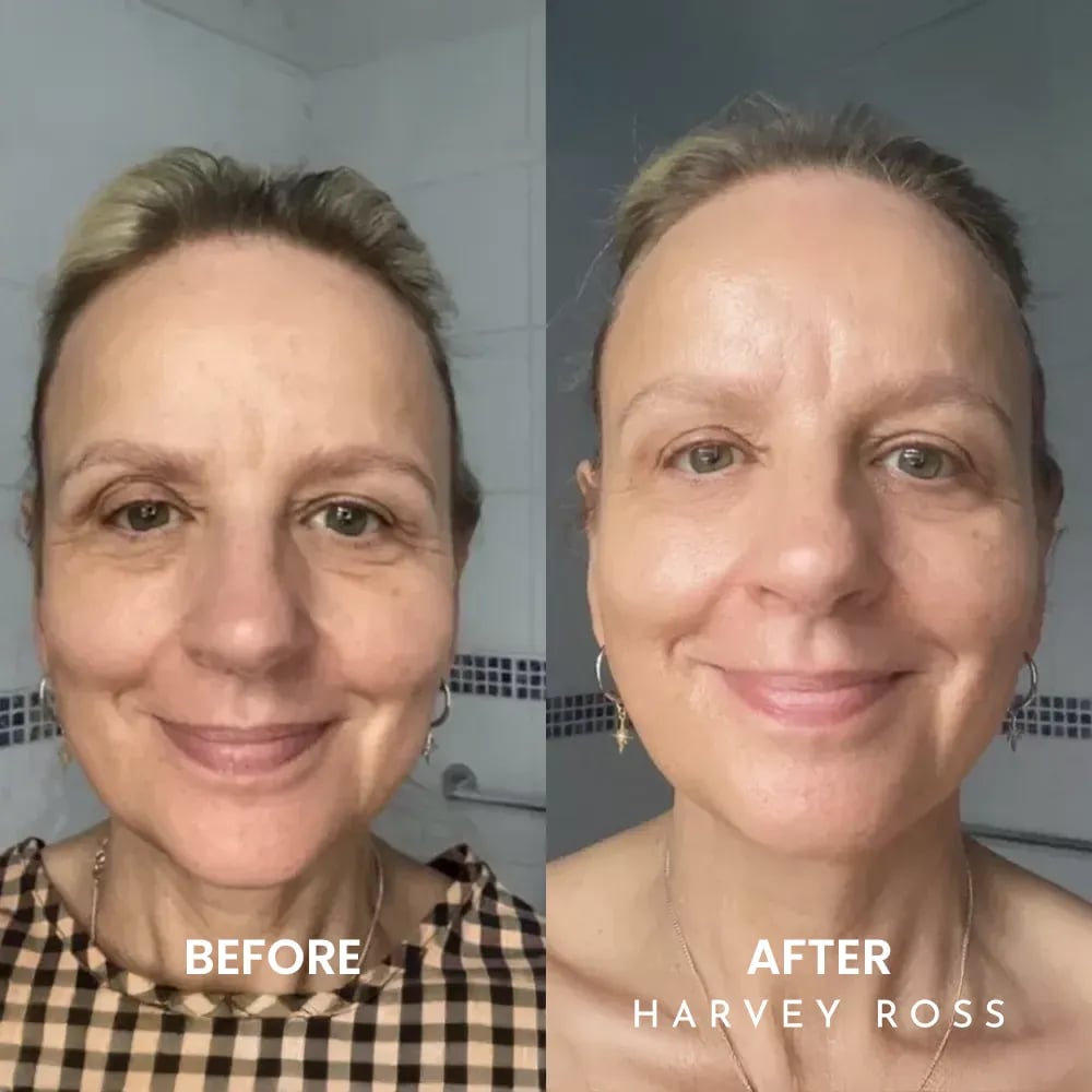 🏆#1 Bestselling🏆Harvey Ross - Instant Lift+