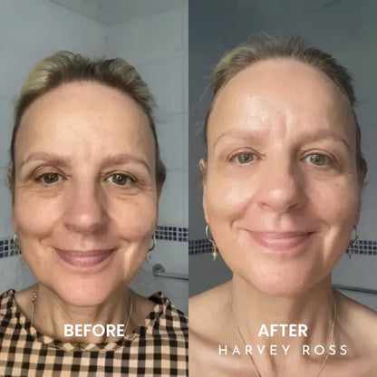 🏆#1 Bestselling🏆Harvey Ross - Instant Lift+