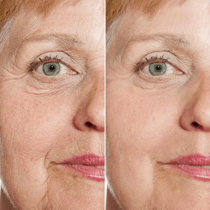 Last Day Promotion✨49% OFF🎁Rejuvenate Face Serum