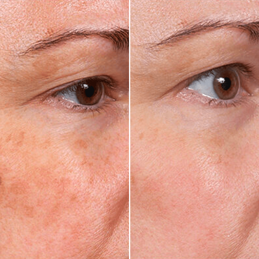 Last Day Promotion✨49% OFF🎁Rejuvenate Face Serum