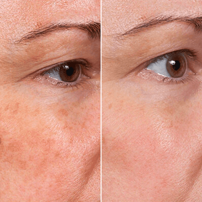 Last Day Promotion✨49% OFF🎁Rejuvenate Face Serum