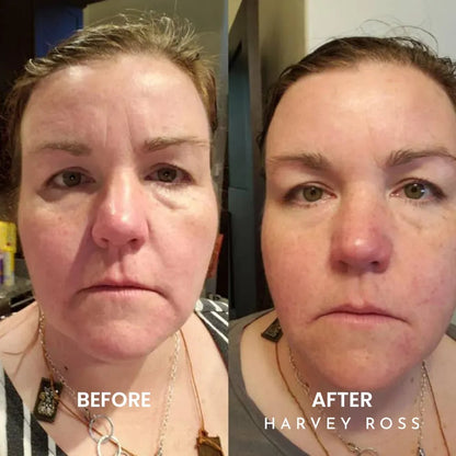 🏆#1 Bestselling🏆Harvey Ross - Instant Lift+