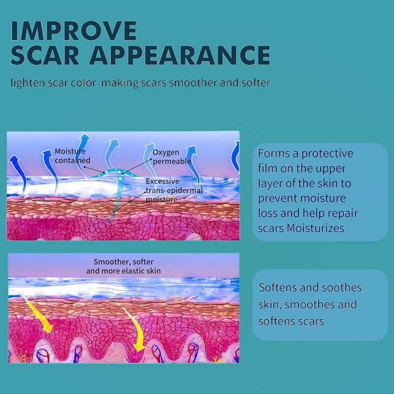 🔥Best scar gel out there -2% Silicone Scar Repair Cream
