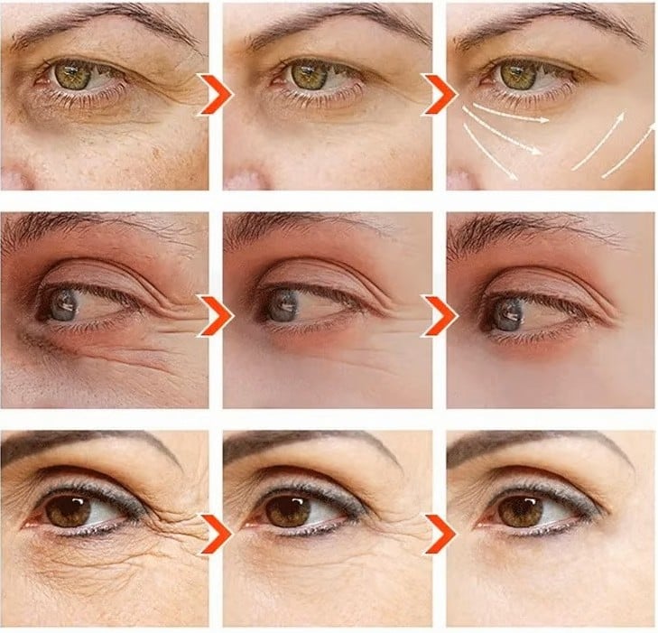 Eye Bag Instant Eraser, Tightens, Firms, & Blurs Wrinkles