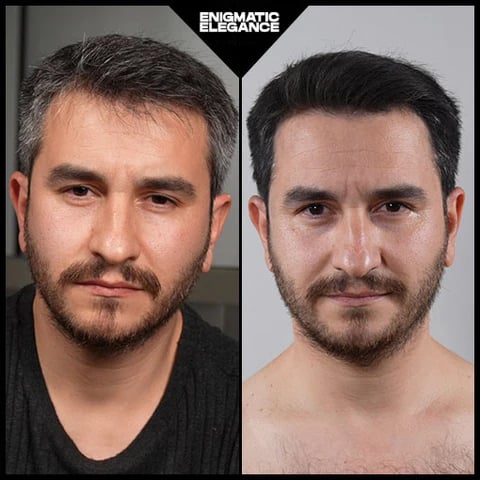 🎅Christmas Hot Sale🔥Natural Anti-Gray Hair Removal Soap